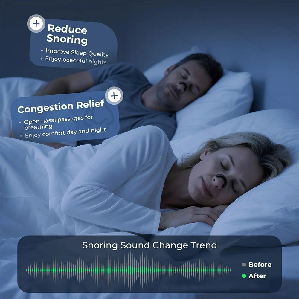 Anti Snoring Nasal Dilator | Effective Physical Expansion Nasal Patch & Non-Invasive Sleep Aid